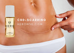 CBD oil benefits for skin